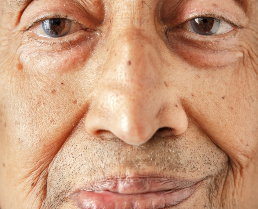“Bionic Face” Kicks Off New Year of Medical Breakthroughs