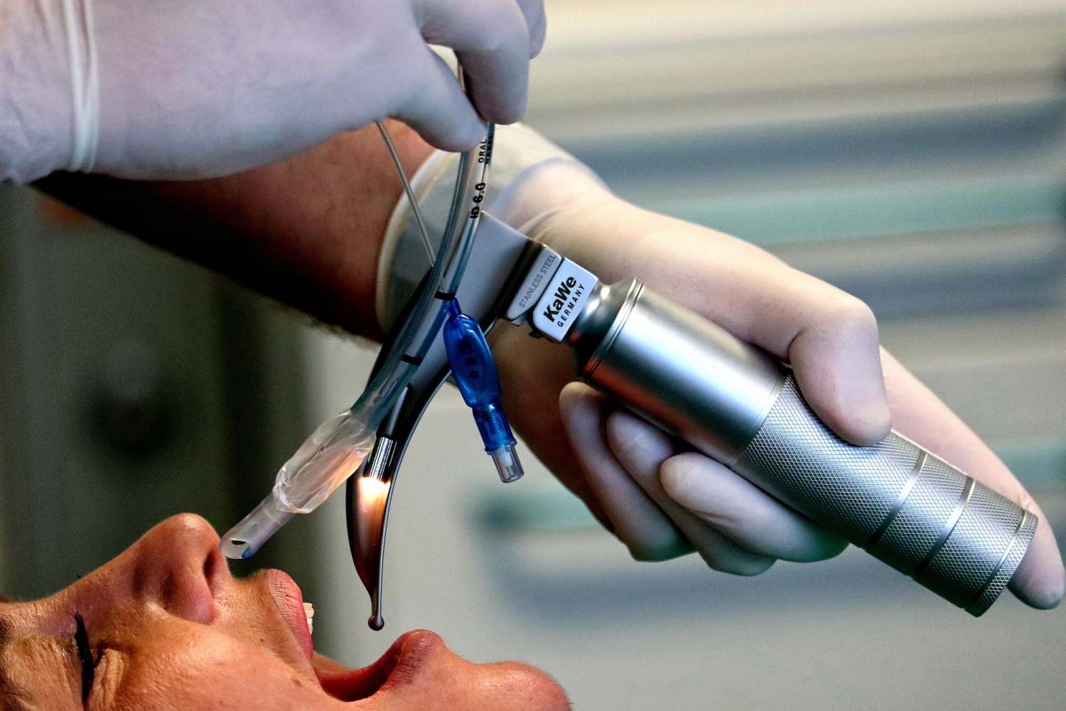 Evaluate 3 3 2 Intubation