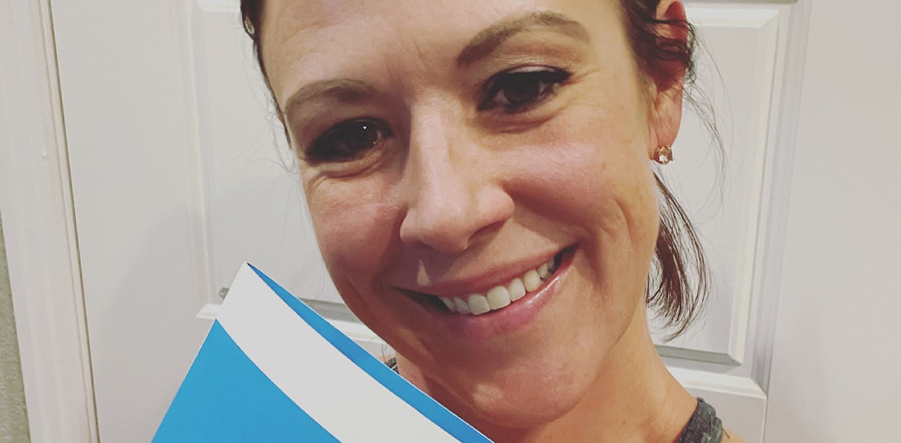 cicatrizarse, de, un, mujer sonriente